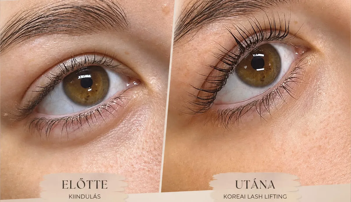 Koreai szempilla lifting — előtte és utána